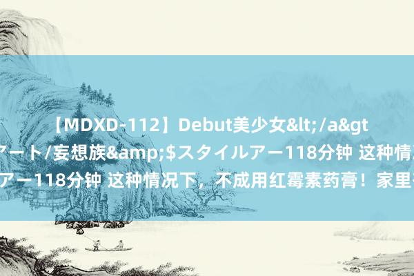 【MDXD-112】Debut美少女</a>2005-02-15スタイルアート/妄想族&$スタイルアー118分钟 这种情况下，不成用红霉素药膏！家里有的防御了